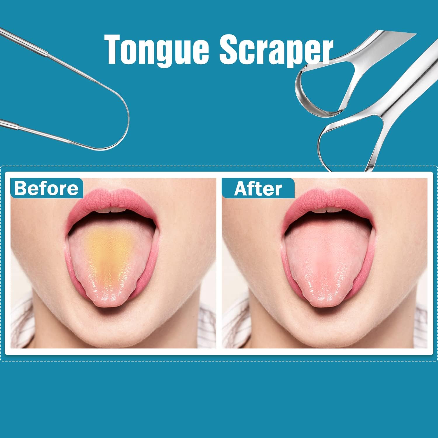 Medical-Grade Stainless Steel Tongue Scraper – Professional Oral Detox & Instant Breath Freshener medical grade stainless steel tongue scraper – professional oral detox & instant breath freshener